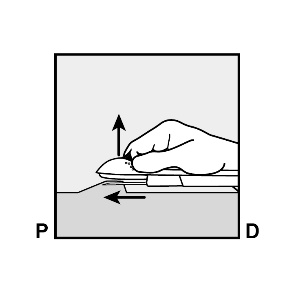Milotden_200042_18MRL_Nexplanon_FIG_6_V3
