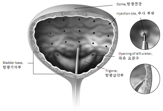 공식 설명서 삽화