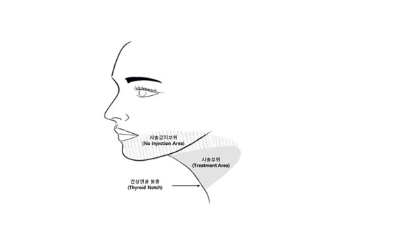 공식 설명서 삽화