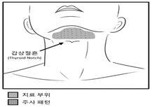 공식 설명서 삽화