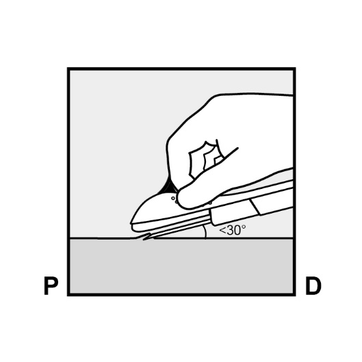 Milotden_200042_18MRL_Nexplanon_FIG_5a_V3