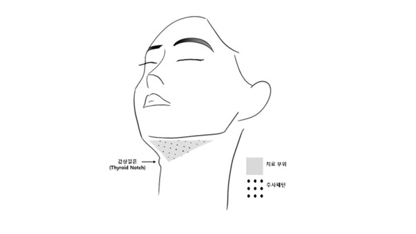 공식 설명서 삽화