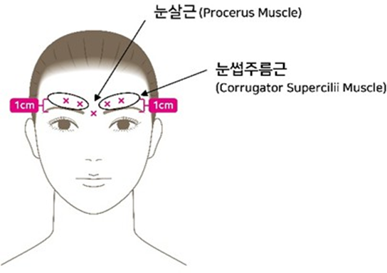 공식 설명서 삽화