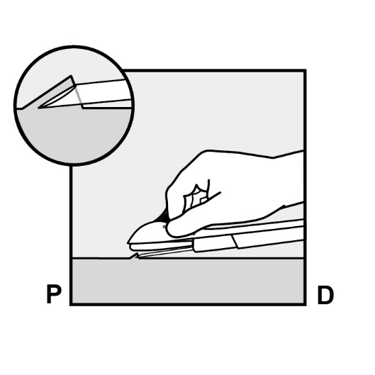 Milotden_200042_18MRL_Nexplanon_FIG_5B_V3