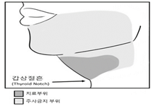 공식 설명서 삽화