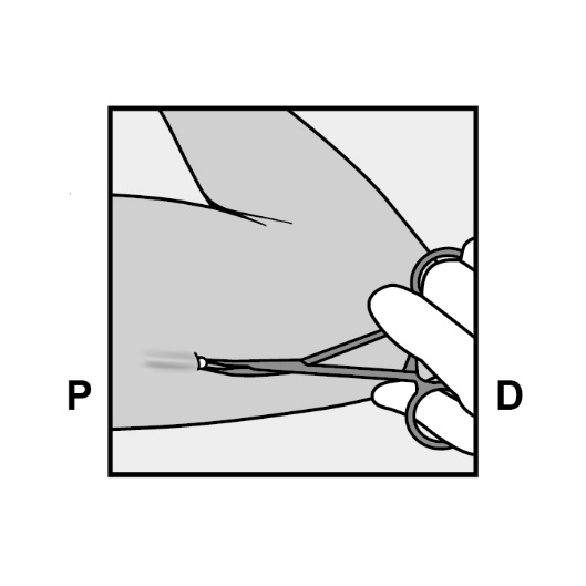 Milotden_200042_18MRL_Nexplanon_FIG_16_V3