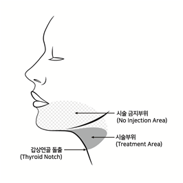 공식 설명서 삽화