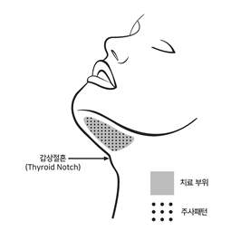 공식 설명서 삽화