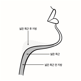 공식 설명서 삽화