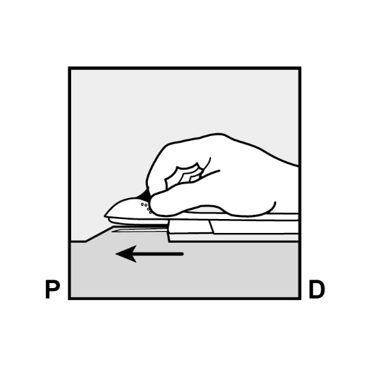 Milotden_200042_18MRL_Nexplanon_FIG_7_V3