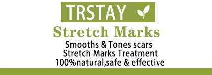 Stretch Marks packaging