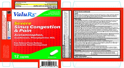 Severe Sinus Congestion and Pain 포장