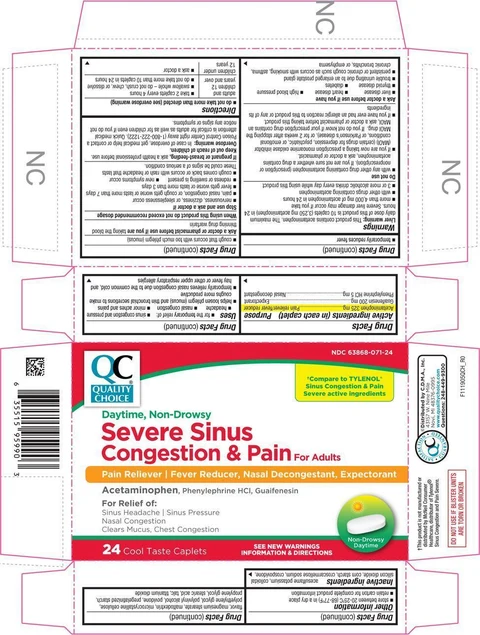Severe Sinus Congestion and Pain 포장