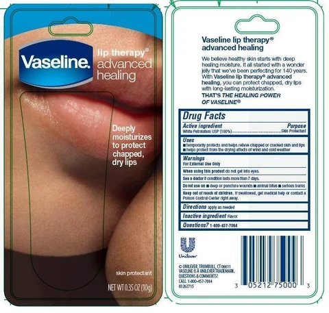 VLTAdvancedBackCard