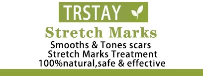 Stretch Marks packaging