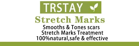 Stretch Marks packaging
