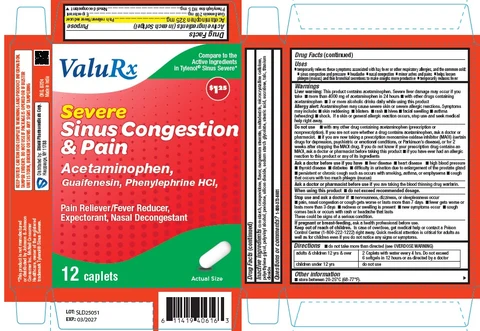 Severe Sinus Congestion and Pain 포장