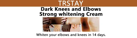 Trstay Dark Knees and Elbows Strong whitening Cream 포장