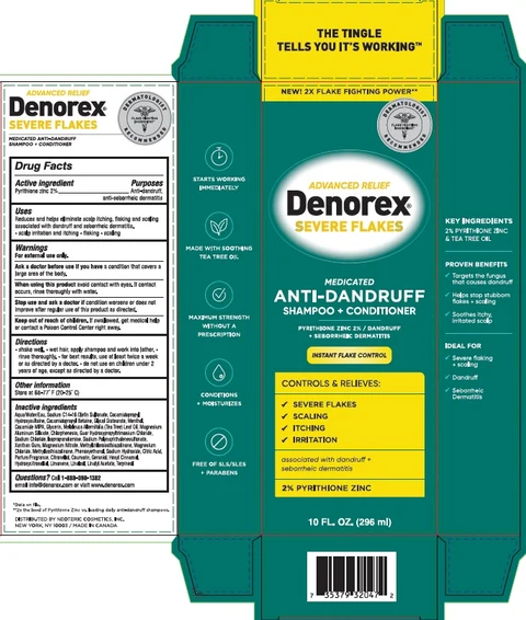 Denorex Severe FlakesMedicated Anti Dandruff 포장